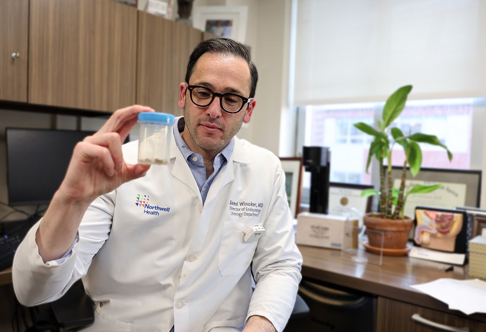 A male physician wearing black glasses and a lab coat looks down at a specimen cup containing kidney stones.
