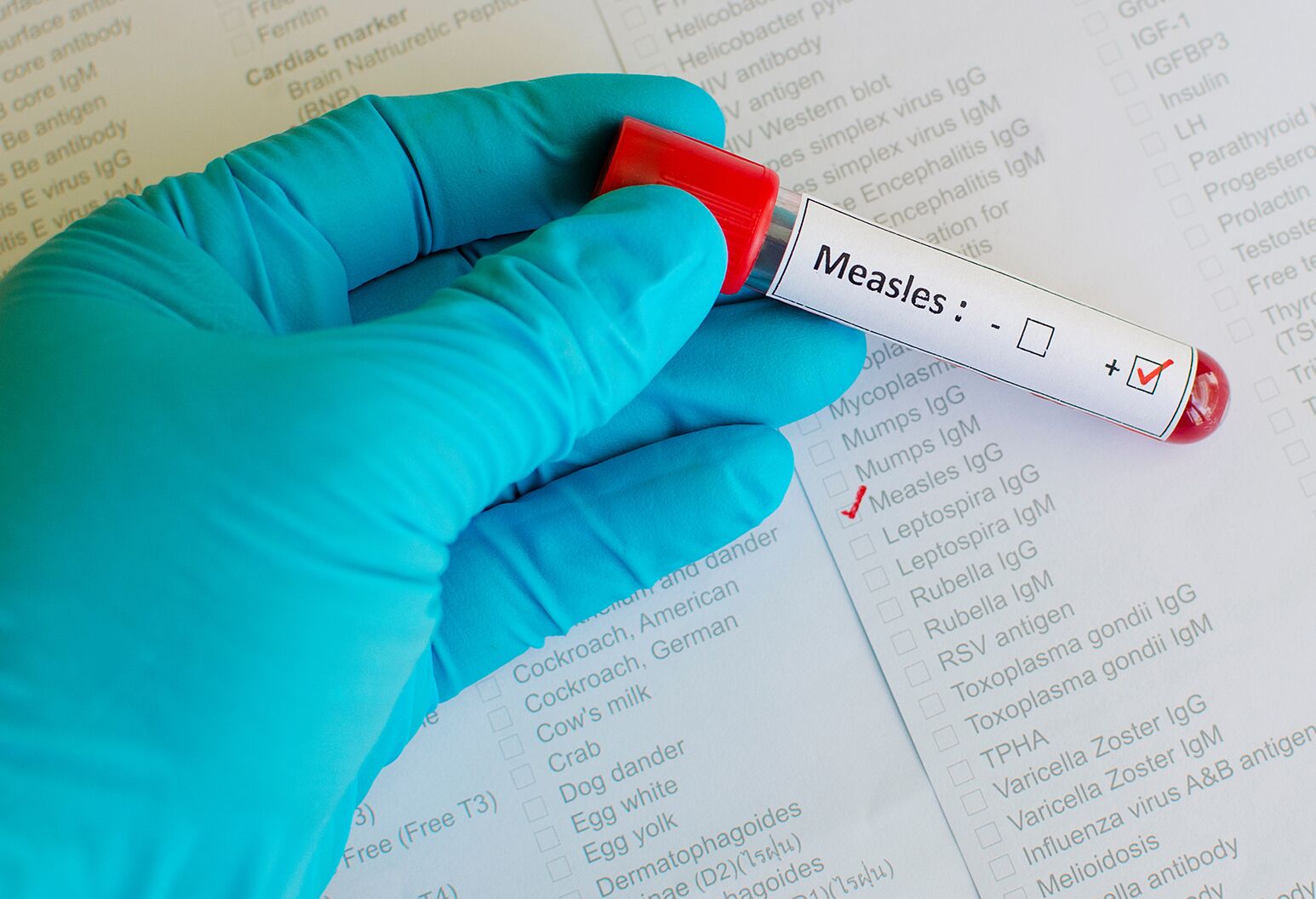 hiv-risk-factors-myths-vs-reality-the-well-by-northwell