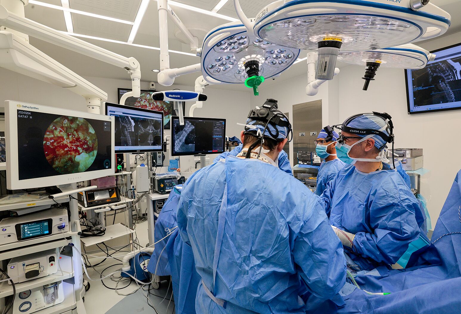 In an operating room, several surgeons look over at a monitor showing an internal view of a patient.