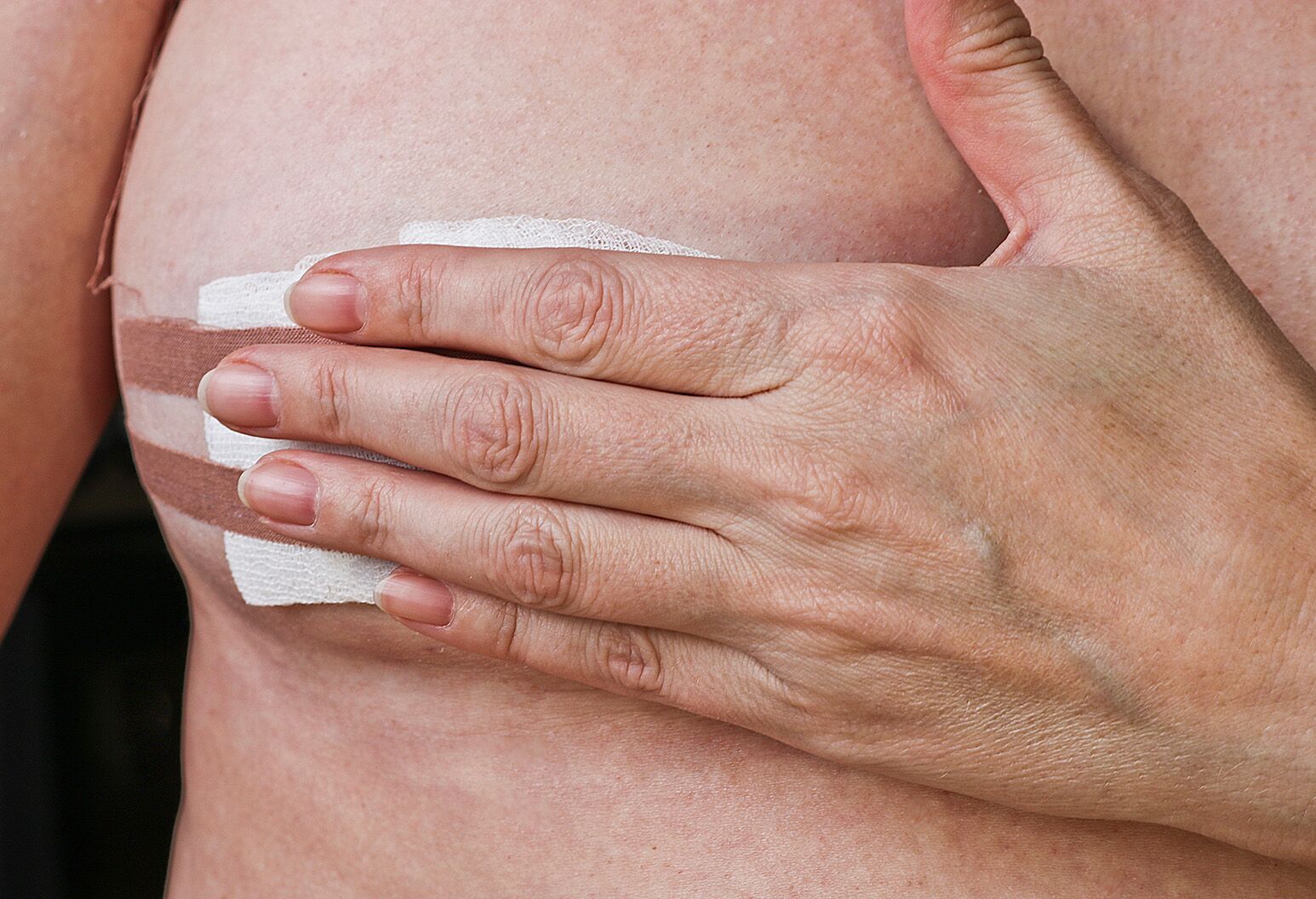wife sex wach core breast biopsies