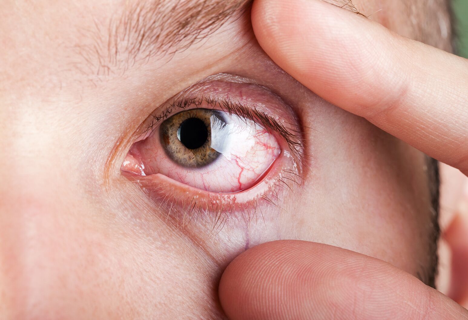 7 health problems predicted with a look into your eyes