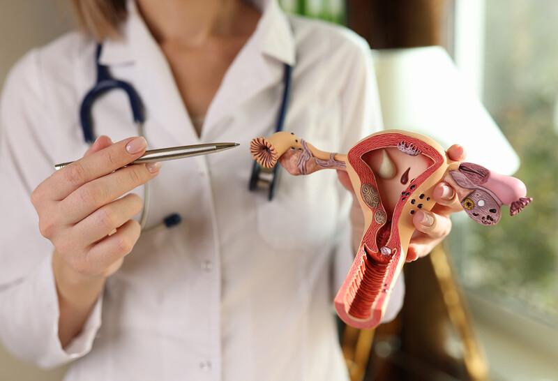 Ovarian Cancer Screening: Early Signs To Watch For | The Well by Northwell