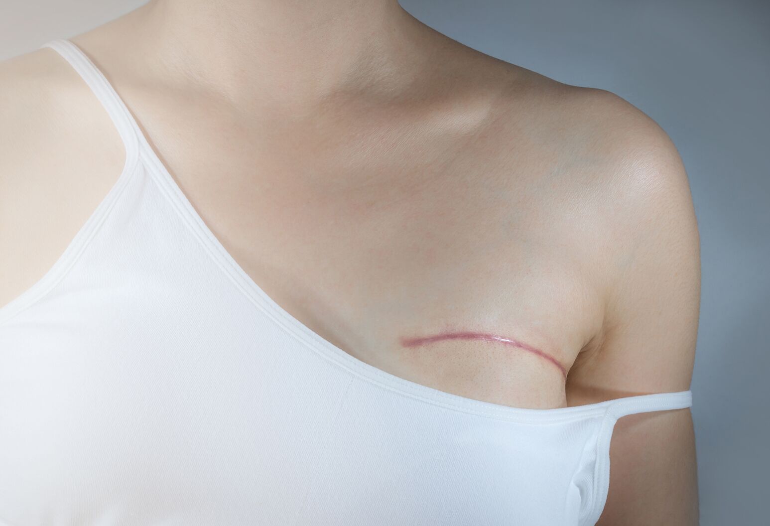 Why I'm happy about having a double mastectomy without
