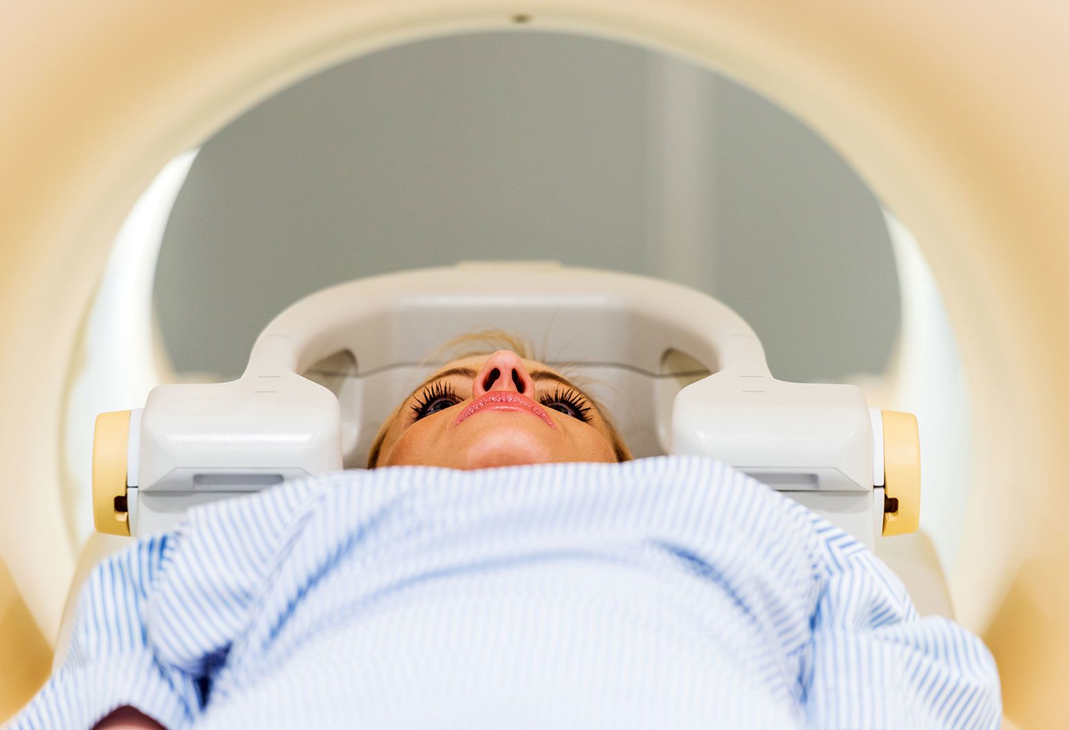 What Breast Cancer Patients Can Expect from Radiation Therapy