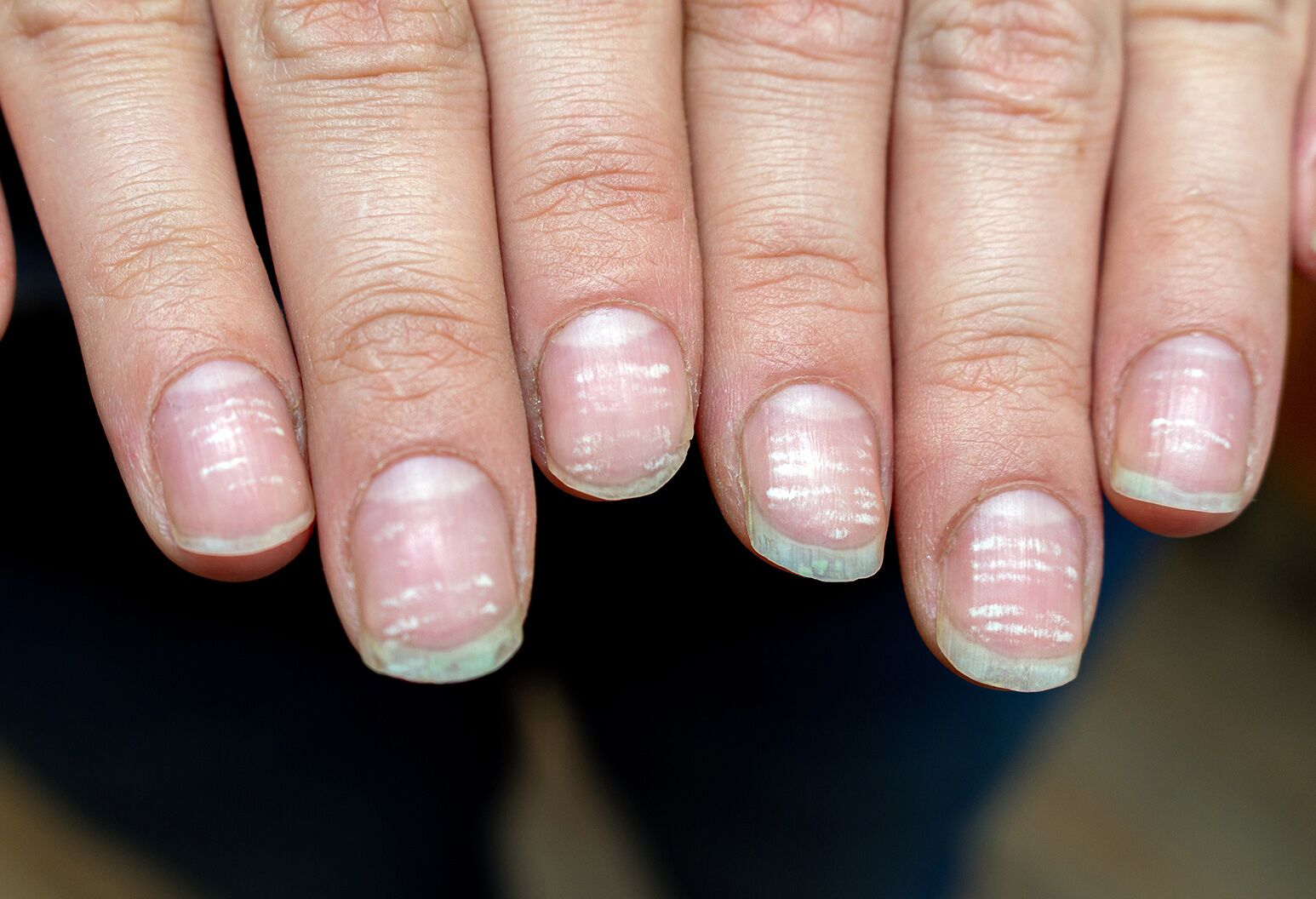 How To Have Good Nails And Improve Your Nail Health