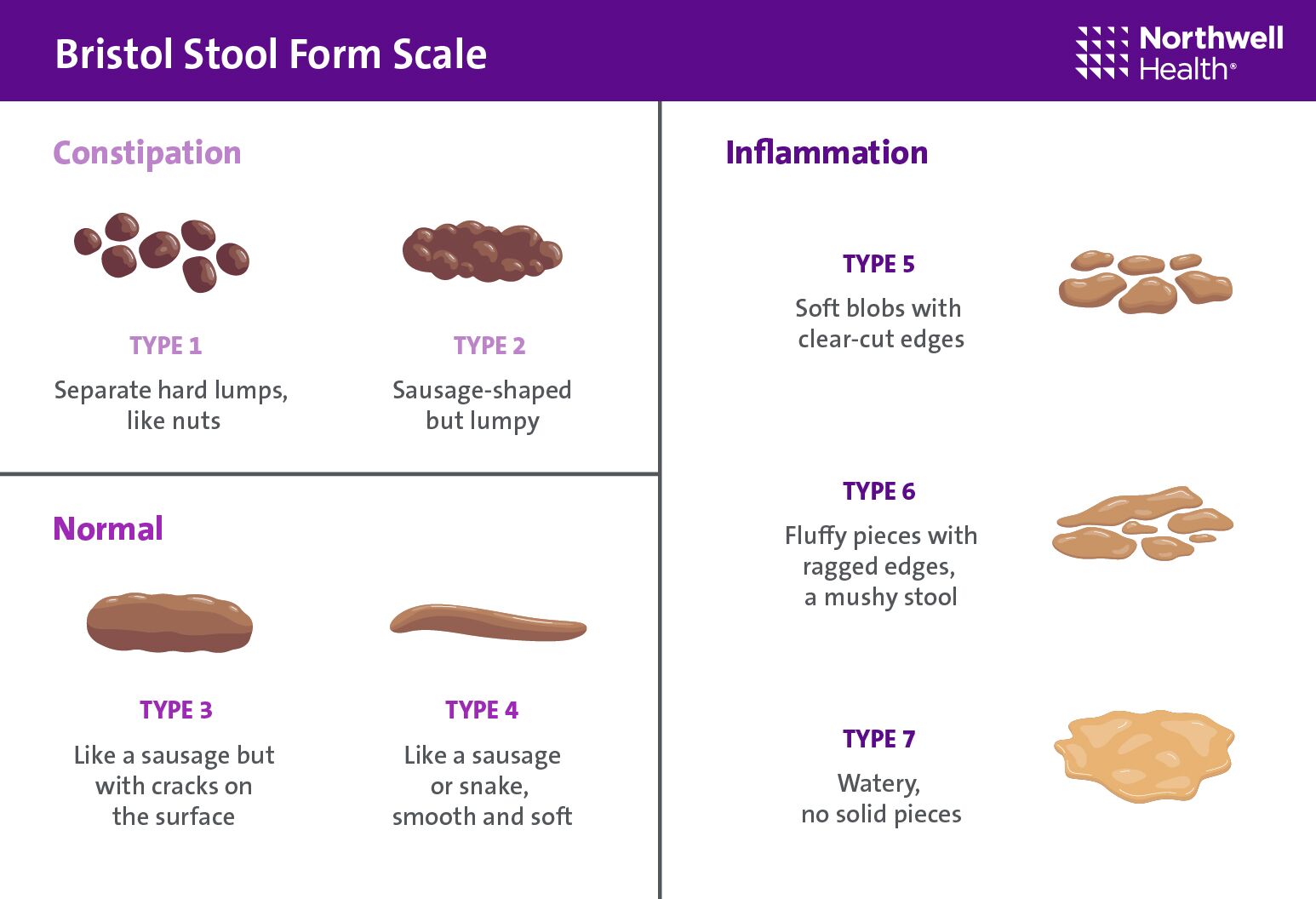 Types of poop: Appearance, color, and what is normal