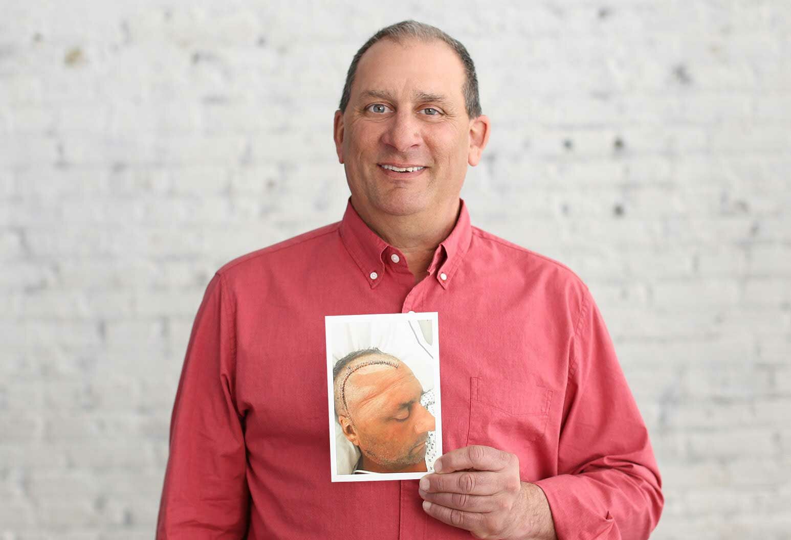 Steve Calzolano holding a photo of himself after surgery