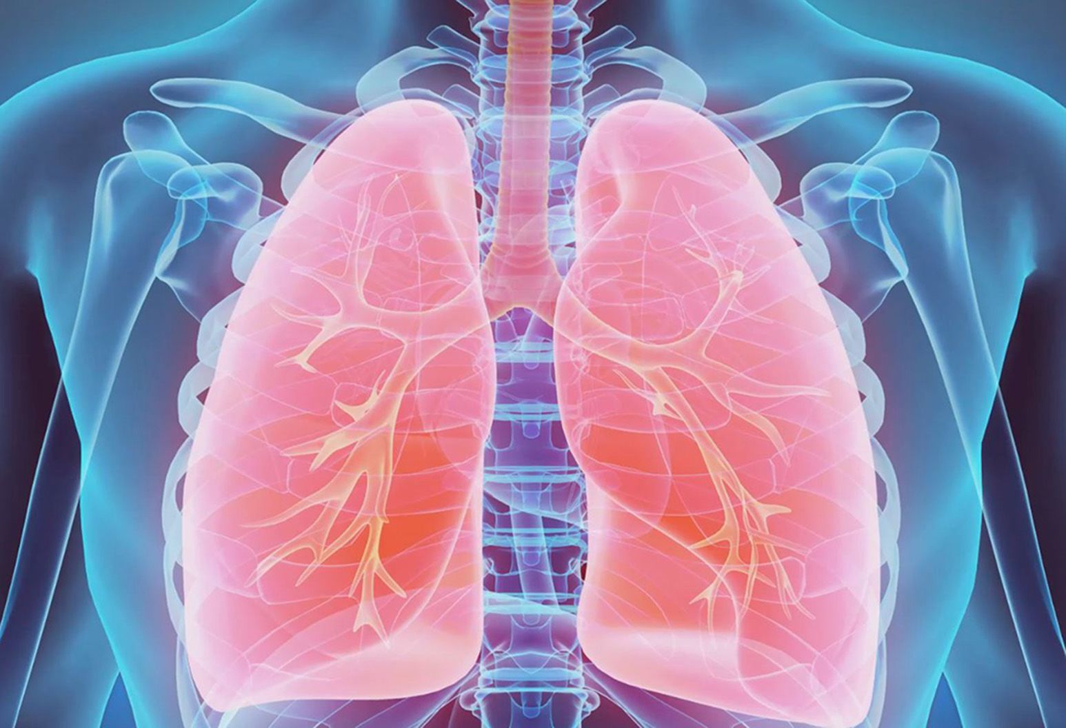 Aspirated Objects Usually Lodge In The Left Lung at Courtney Mason blog