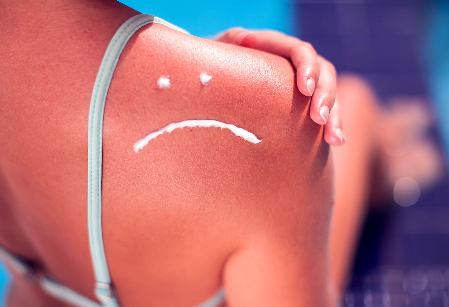 sun-poisoning-vs-sunburn-the-well-by-northwell